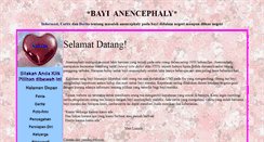 Desktop Screenshot of bayi-anencephaly.info